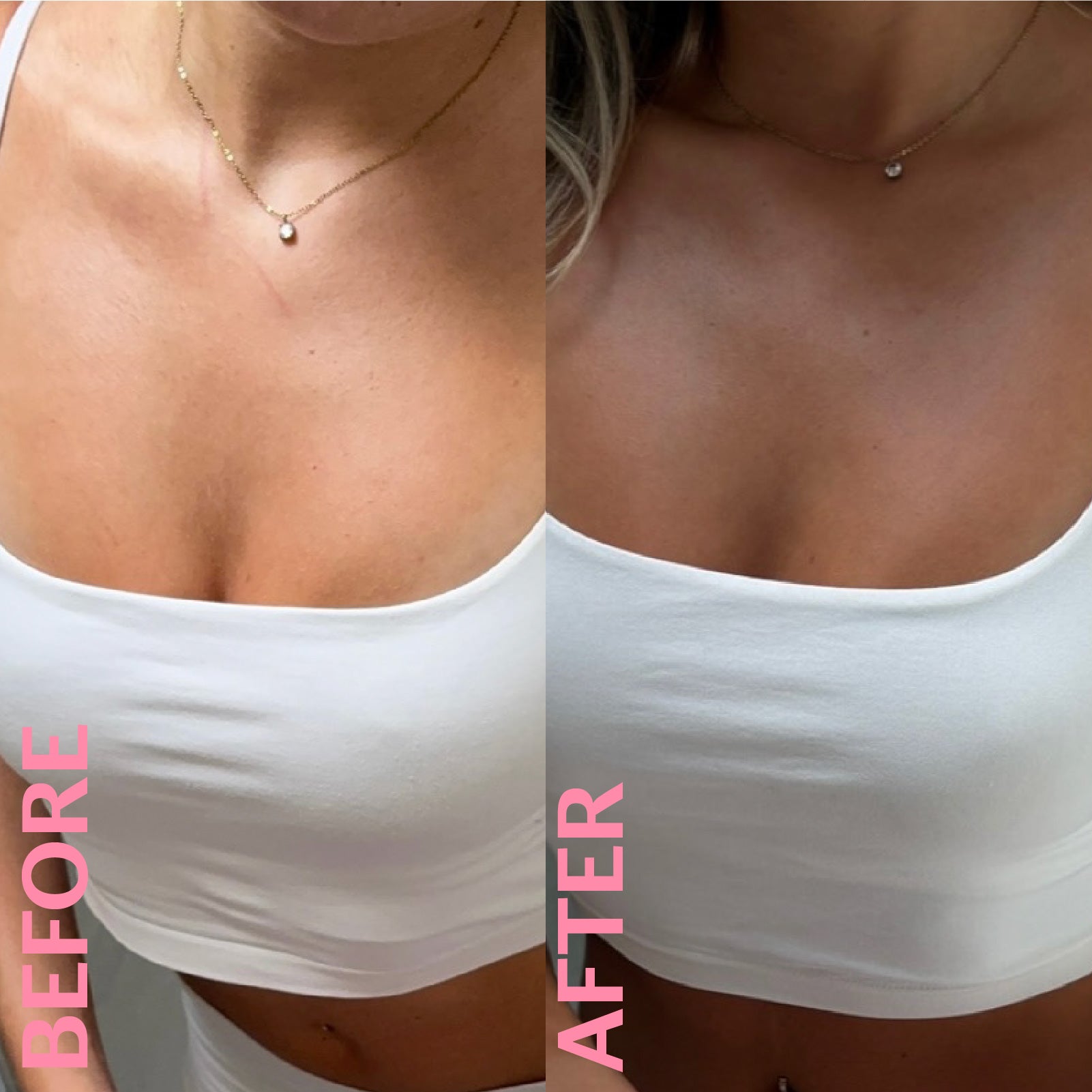Medium Shade Clear Whipped Tan Before & After